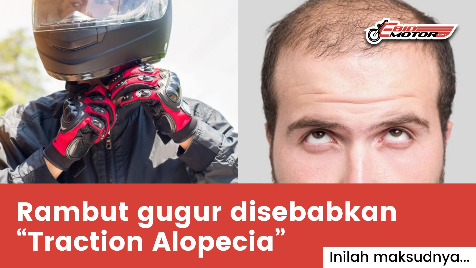 Helmet Akan Menyebabkan Keguguran Rambut !